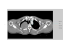 Brac_Plx_L aorta Spinal cord Esophagus