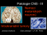 Patologie CNS III - Ústav patologie 1.LF UK a VFN